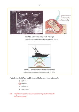 26
ภำพที่ 2.5 กำรตรวจครรภ์ด้วยคลื่นเสียงควำมถี่สูง
(สถาบันส่งเสริมการสอนวิทยาศาสตร์และเทคโนโลยี, 2554)
ภำพที่ 2.6 กำรหำควำมลึกของทะเลจำกเครื่องโซนำร์
(http://www.raymarine.com/view/?id=3173, 2557)
ตัวอย่ำงที่ 2.10 วัสดุที่ใช้ในการบุผนังโรงภาพยนตร์มีผลในการลดปรากฏการณ์ใดของเสียง
1. การหักเห
2. การสะท้อน
3. การเลี้ยวเบน
4. การแทรกสอด

ตอบ วัสดุที่ใช้ในการบุผนังโรงภาพยนตร์จะช่วยลดปรากฏการณ์สะท้อนของเสียง
ดังนั้น ตอบตัวเลือกที่ 2
 
