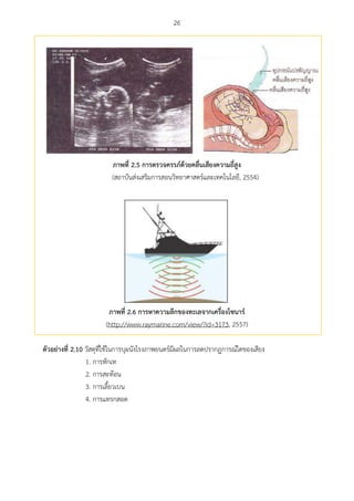26
ภำพที่ 2.5 กำรตรวจครรภ์ด้วยคลื่นเสียงควำมถี่สูง
(สถาบันส่งเสริมการสอนวิทยาศาสตร์และเทคโนโลยี, 2554)
ภำพที่ 2.6 กำรหำควำมลึกของทะเลจำกเครื่องโซนำร์
(http://www.raymarine.com/view/?id=3173, 2557)
ตัวอย่ำงที่ 2.10 วัสดุที่ใช้ในการบุผนังโรงภาพยนตร์มีผลในการลดปรากฏการณ์ใดของเสียง
1. การหักเห
2. การสะท้อน
3. การเลี้ยวเบน
4. การแทรกสอด
 