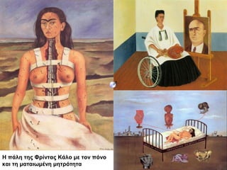 Η πάλη της Φρίντας Κάλο με τον πόνο
και τη ματαιωμένη μητρότητα
 