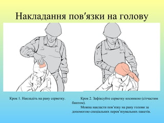 Накладання пов′язки на голову
Крок 1. Накладіть на рану серветку. Крок 2. Зафіксуйте серветку косинкою (сітчастим
бинтом).
Можна накласти пов’язку на рану голови за
допомогою спеціальних перев’язувальних пакетів.
 