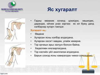 Ажлын байранд яаралтай анхны тусламж үзүүлэх нь | PPT