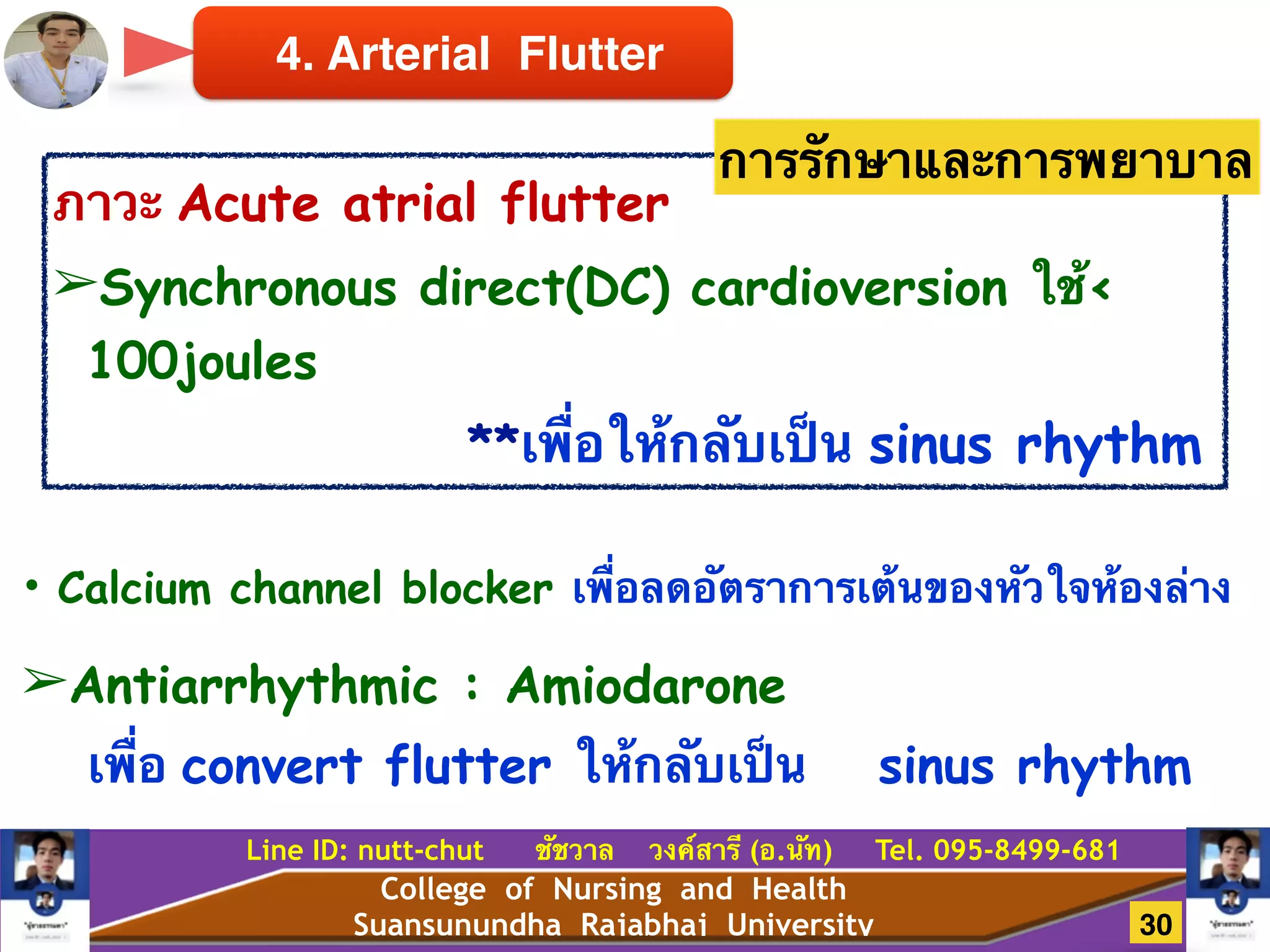 College of Nursing and Health
Suansunundha Rajabhaj University
Line ID: nutt-chut ชัชวาล วงค์สารี (อ.นัท) Tel. 095-8499-681
ภาวะ Acute atrial flutter
➢Synchronous direct(DC) cardioversion ใช้<
100joules
**เพื่อให้กลับเป็น sinus rhythm
การรักษาและการพยาบาล
4. Arterial Flutter
• Calcium channel blocker เพื่อลดอัตราการเต้นของหัวใจห้องล่าง
➢Antiarrhythmic : Amiodarone
เพื่อ convert flutter ให้กลับเป็น sinus rhythm
30
 