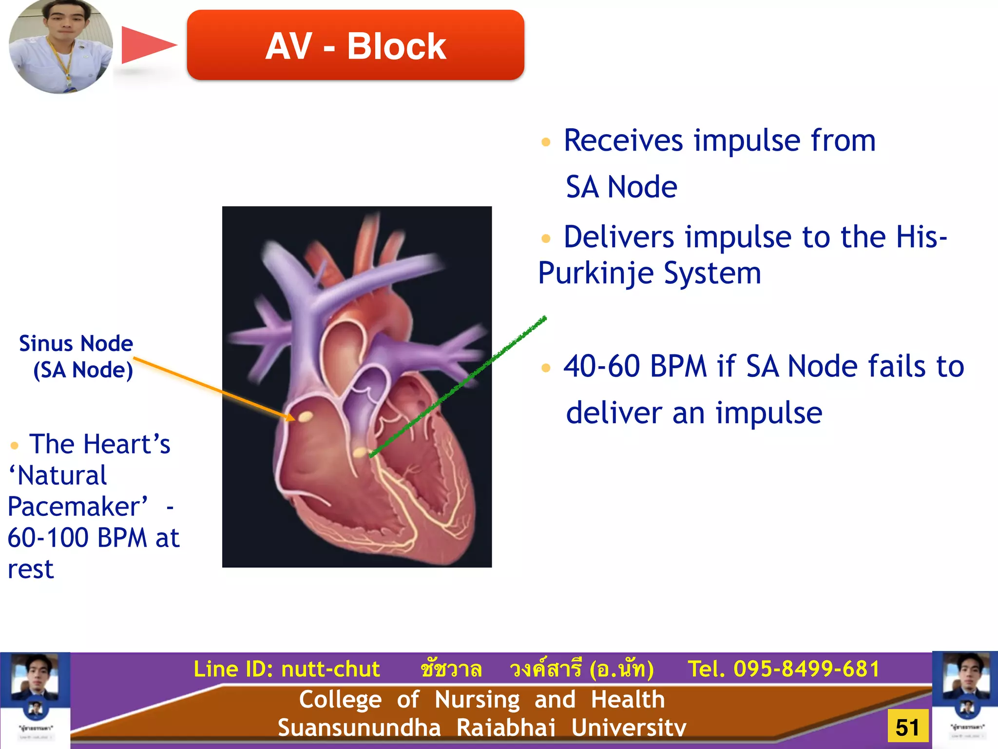 College of Nursing and Health
Suansunundha Rajabhaj University
Line ID: nutt-chut ชัชวาล วงค์สารี (อ.นัท) Tel. 095-8499-681
AV - Block
!
• Receives impulse from
SA Node
!
• Delivers impulse to the His-
Purkinje System
!
• 40-60 BPM if SA Node fails to
deliver an impulse
Sinus Node
(SA Node)
!
• The Heart’s
‘Natural
Pacemaker’ -
60-100 BPM at
rest
51
 