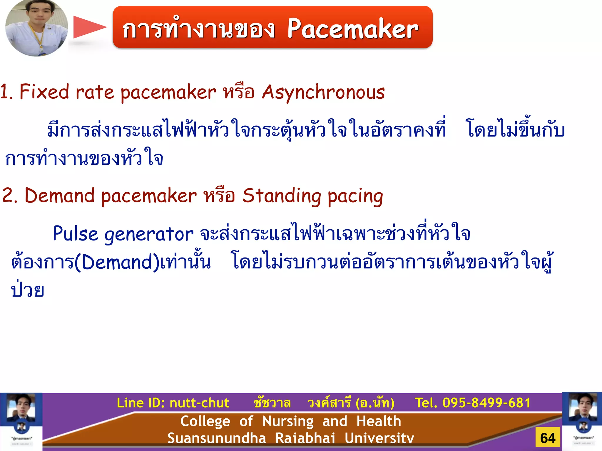 College of Nursing and Health
Suansunundha Rajabhaj University
Line ID: nutt-chut ชัชวาล วงค์สารี (อ.นัท) Tel. 095-8499-681
1. Fixed rate pacemaker หรือ Asynchronous
มีการส่งกระแสไฟฟ้าหัวใจกระตุ้นหัวใจในอัตราคงที่ โดยไม่ขึ้นกับ
การทำงานของหัวใจ
2. Demand pacemaker หรือ Standing pacing
Pulse generator จะส่งกระแสไฟฟ้าเฉพาะช่วงที่หัวใจ
ต้องการ(Demand)เท่านั้น โดยไม่รบกวนต่ออัตราการเต้นของหัวใจผู้
ป่วย
การทำงานของ Pacemaker
64
 