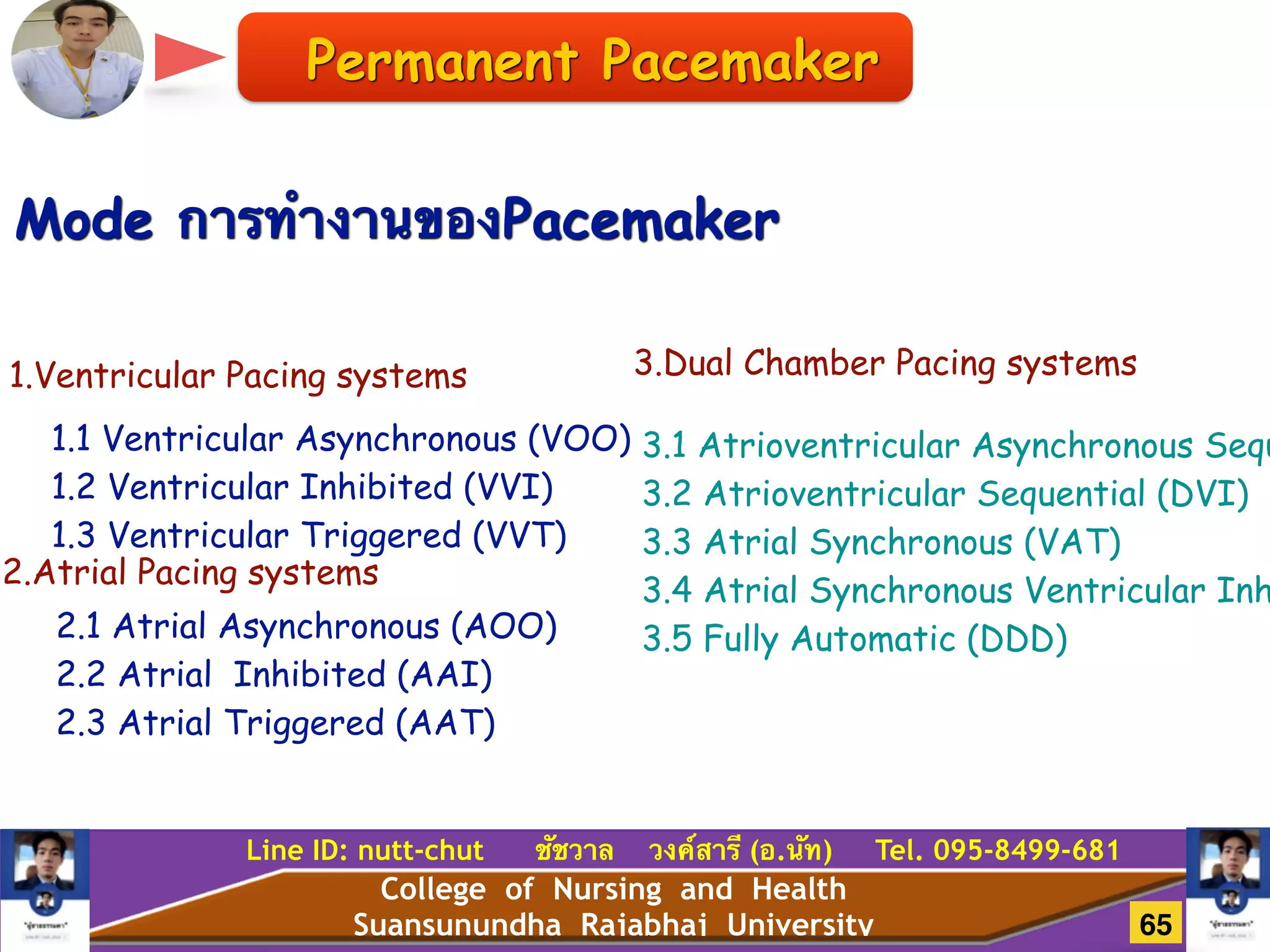 College of Nursing and Health
Suansunundha Rajabhaj University
Line ID: nutt-chut ชัชวาล วงค์สารี (อ.นัท) Tel. 095-8499-681
Mode การทำงานของPacemaker
1.Ventricular Pacing systems
1.1 Ventricular Asynchronous (VOO)
1.2 Ventricular Inhibited (VVI)
1.3 Ventricular Triggered (VVT)
2.1 Atrial Asynchronous (AOO)
2.2 Atrial Inhibited (AAI)
2.3 Atrial Triggered (AAT)
2.Atrial Pacing systems
Permanent Pacemaker
3.Dual Chamber Pacing systems
3.1 Atrioventricular Asynchronous Sequ
3.2 Atrioventricular Sequential (DVI)
3.3 Atrial Synchronous (VAT)
3.4 Atrial Synchronous Ventricular Inh
3.5 Fully Automatic (DDD)
!
65
 
