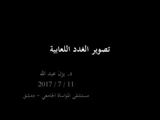 ‫اللعابية‬ ‫الغدد‬ ‫تصوير‬
‫د‬.‫هللا‬ ‫عبد‬ ‫يزن‬
11/7/2017
‫اجلامعي‬ ‫اساة‬‫و‬‫امل‬ ‫مستشفى‬-‫دمشق‬
 