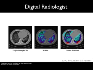 Digital Radiologist
Med Phys. 2013 May;40(5):051912. doi: 10.1118/1.4802214.
Collaboration with Prof. Joon Beom Seo (Asan Medical Center)
Analysed 1200 patients for 3 months
 
