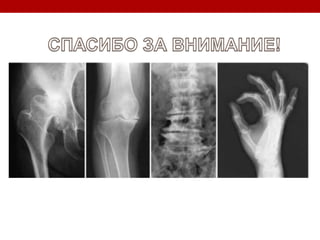 Болезнь модифицирующая терапия остеоартрита