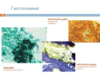 Гистохимия
23
Aspiragiles
-альциановый голубой
Helicobacter pylori
- -альциановый голубой
желтый
Helicobacter pylori
импрегнация
серебром
 