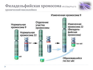 Филадельфийская хромосома t(9;22)(q34;q11)
хронический миелолейкоз
 