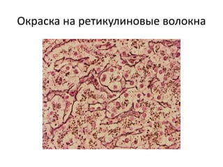Окраска на ретикулиновые волокна
 