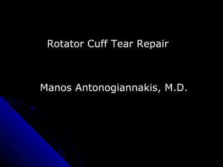 Rotator Cuff Tear Repair
Manos Antonogiannakis, M.D.
 