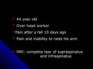  44 year old
 Over head worker
Pain after a fall 10 days ago
 Pain and inability to raise his arm
 MRI: complete tear...
