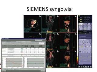 SIEMENS syngo.via
 