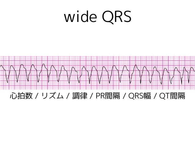 心電図の話 基本の き