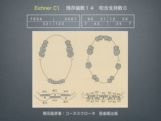 Kc Qmhoma004m