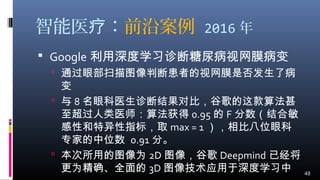 智能医 ：疗 前沿案例 2016 年
 Google 利用深度学习诊断糖尿病视网膜病变
 通过眼部扫描图像判断患者的视网膜是否发生了病
变
 与 8 名眼科医生诊断结果对比，谷歌的这款算法甚
至超过人类医师：算法获得 0.95 的 F 分数（结合敏
感性和特异性指标，取 max = 1 ），相比八位眼科
专家的中位数 0.91 分。
 本次所用的图像为 2D 图像，谷歌 Deepmind 已经将
更为精确、全面的 3D 图像技术应用于深度学习中 48
 