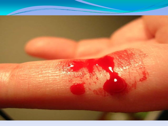 цус алдалтын үед авах арга хэмжээ | PPT