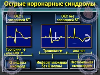 Тропонин
или КФК
ОКС с
элевацией ST
Q инфаркт
миокарда
Тропонин или нет
ОКС без
элевацией ST
Нестабильная
стенокардия
Инфаркт миокарда
без Q волны
 