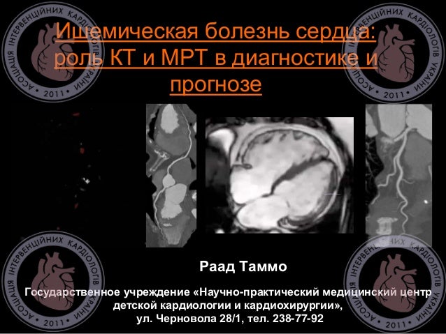Болезнь фара на кт