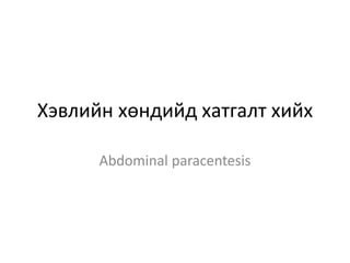 Хэвлийн хөндийд хатгалт хийх
Abdominal paracentesis
 