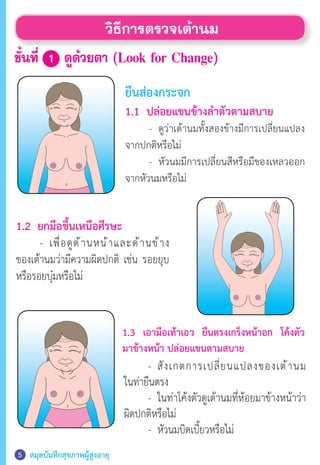 สมุดบันทึกสุขภาพผู้สูงอายุ5
วิธีการตรวจเต้านม
ขั้นที่ 1 ดูด้วยตา (Look for Change)
ยืนส่องกระจก
1.1 ปล่อยแขนข้างล�ำตัวตามสบาย
	 	 -	 ดูว่าเต้านมทั้งสองข้างมีการเปลี่ยนแปลง
จากปกติหรือไม่
	 	 -	 หัวนมมีการเปลี่ยนสีหรือมีของเหลวออก
จากหัวนมหรือไม่
1.2 ยกมือขึ้นเหนือศีรษะ
	 	 -	 เพื่อดูด้านหน้าและด้านข้าง
ของเต้านมว่ามีความผิดปกติ เช่น รอยยุบ
หรือรอยบุ๋มหรือไม่
1.3 เอามือเท้าเอว ยืนตรงเกร็งหน้าอก โค้งตัว
มาข้างหน้า ปล่อยแขนตามสบาย
		-	 สังเกตการเปลี่ยนแปลงของเต้านม
ในท่ายืนตรง
	 	 -	 ในท่าโค้งตัวดูเต้านมที่ห้อยมาข้างหน้าว่า
ผิดปกติหรือไม่
	 	 -	 หัวนมบิดเบี้ยวหรือไม่
 