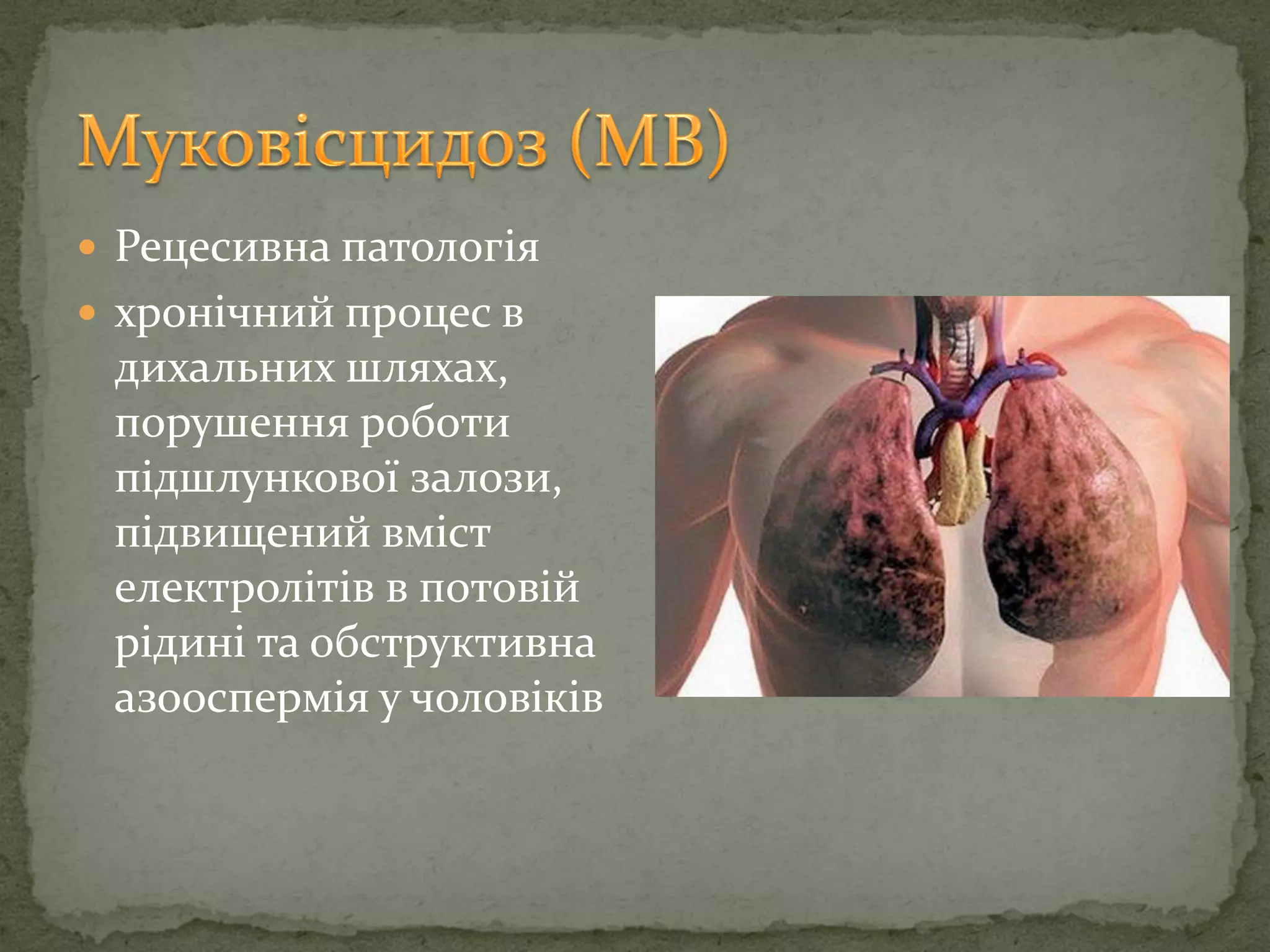  Рецесивна патологія
 хронічний процес в
дихальних шляхах,
порушення роботи
підшлункової залози,
підвищений вміст
електролітів в потовій
рідині та обструктивна
азооспермія у чоловіків
 