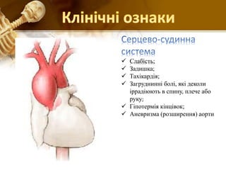 Синдром Марфана | PPT