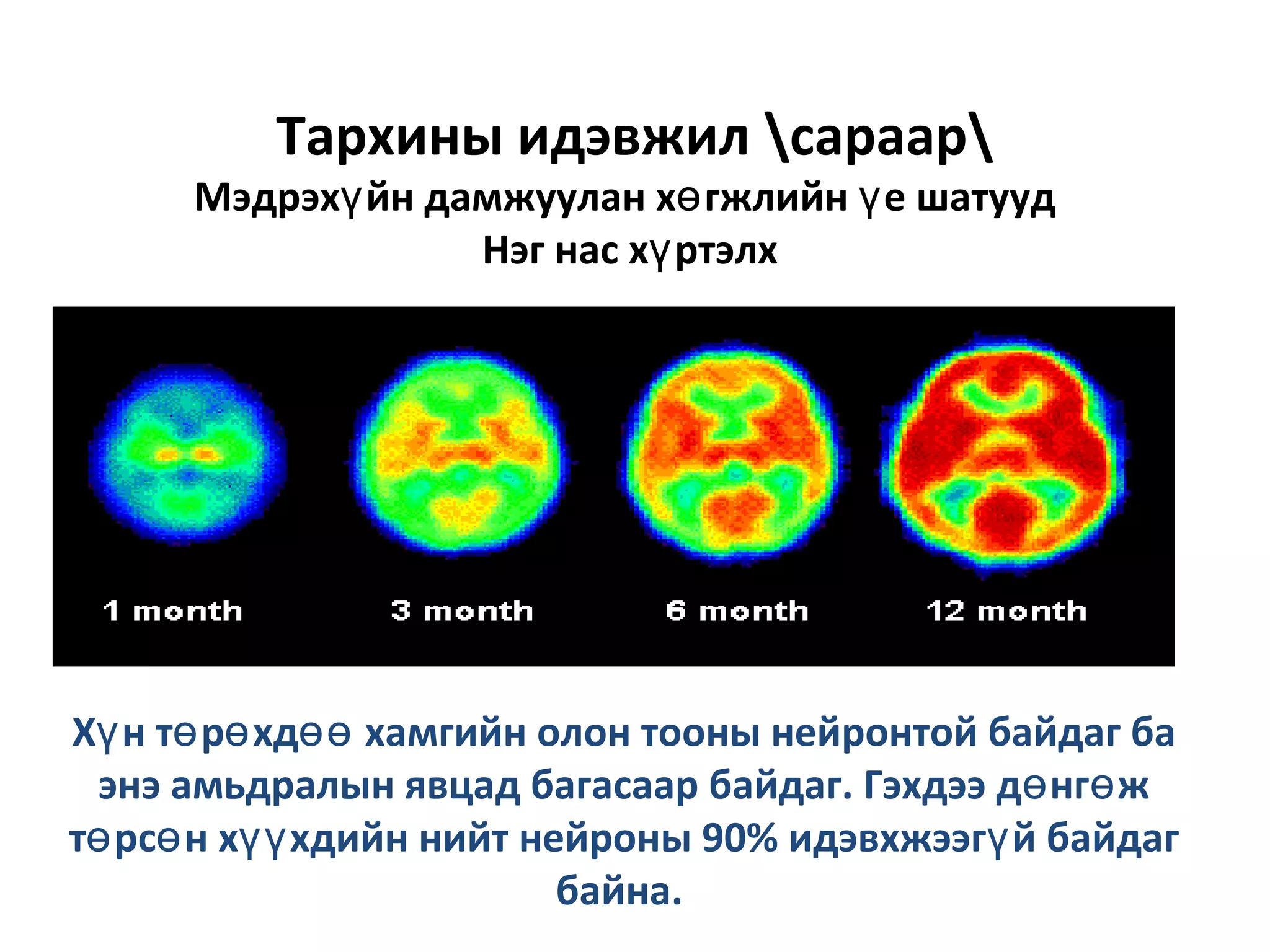 Дээд мэдрэл | PPT