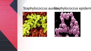 Staphylococcus epidermStaphylococcus aureus
 