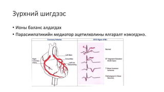 синусын брадикарди | PPT