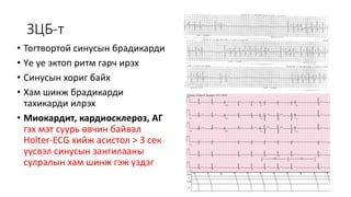синусын брадикарди | PPT