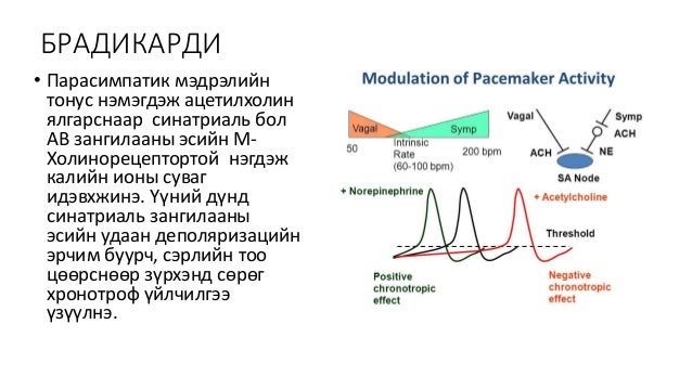 синусын брадикарди