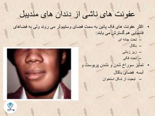 ‫مندیبل‬ ‫های‬ ‫دندان‬ ‫از‬ ‫ناشی‬ ‫های‬ ‫عفونت‬
•‫ف‬ ‫به‬ ‫ولی‬ ‫روند‬ ‫می‬ ‫وستیبولر‬ ‫فضای‬ ‫سمت‬ ‫به‬ ‫پائین‬ ‫فک‬ ‫های‬ ‫عفونت‬ ‫اکثر‬‫ضاهای‬
‫یابند‬ ‫می‬ ‫گسترش‬ ‫هم‬ ‫فاسیایی‬:
–‫ای‬ ‫چانه‬ ‫تحت‬
–‫باکال‬
–‫زبانی‬ ‫زیر‬
–‫فکی‬ ‫تحت‬
•‫و‬ ‫پریوست‬ ‫نشدن‬ ‫و‬ ‫شدن‬ ‫سوراخ‬ ‫تمایز‬
‫باکال‬ ‫فضای‬ ‫آبسه‬
–‫استخوان‬ ‫شکل‬ ‫از‬ ‫تبعیت‬
 