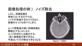 747.5 2次元ウェーブレット変換
画像処理の例 2 ノイズ除去
しかし、詳細係数を
単純に0にするだけでは、
ノイズが低減するだけではなく、
画像のエッジもぼけてしまう。
よって解像度の高い詳細係数を
閾値化することにより、
エッジのぼかしは減少する。
（逆に解像度が高すぎると、
今度はノイズが除去できなくなる） Figure 7.28(b)
 