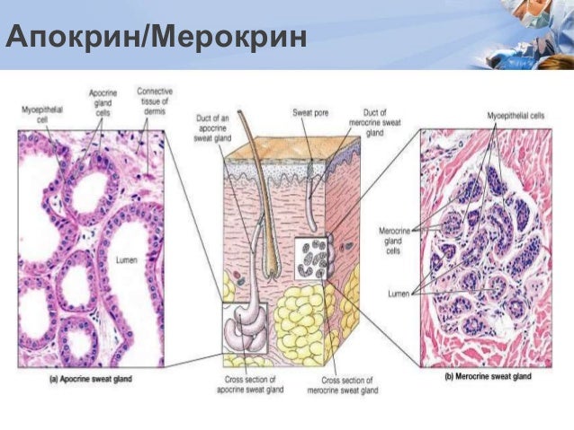 Хөлсний булчирхайн хоргүй хавдар