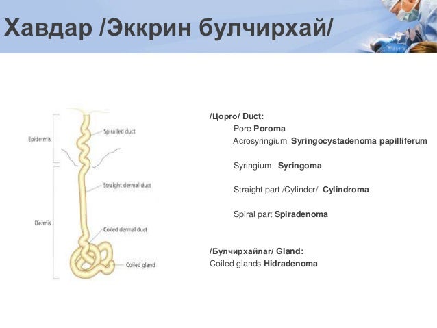 Хөлсний булчирхайн хоргүй хавдар