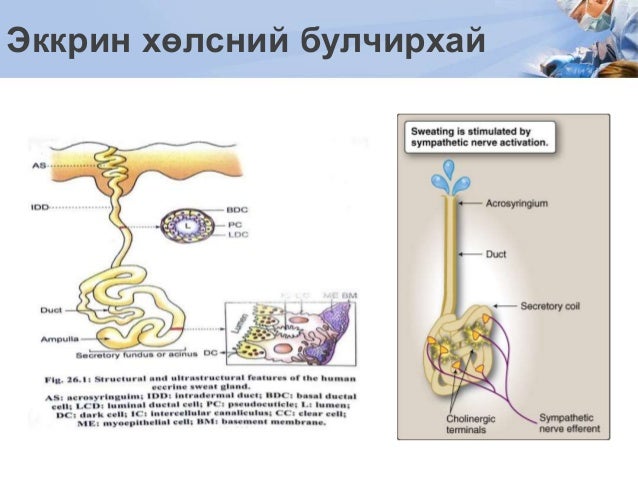 Хөлсний булчирхайн хоргүй хавдар