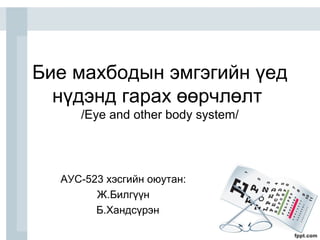 Бие махбодын эмгэгийн үед
нүдэнд гарах өөрчлөлт
/Eye and other body system/
АУС-523 хэсгийн оюутан:
Ж.Билгүүн
Б.Хандсүрэн
 