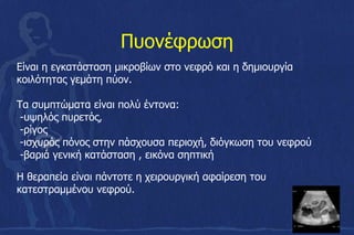 Πυονέφρωση
Είναι η εγκατάσταση μικροβίων στο νεφρό και η δημιουργία
κοιλότητας γεμάτη πύον.
Τα συμπτώματα είναι πολύ έντονα:
-υψηλός πυρετός,
-ρίγος
-ισχυρός πόνος στην πάσχουσα περιοχή, διόγκωση του νεφρού
-βαριά γενική κατάσταση , εικόνα σηπτική
Η θεραπεία είναι πάντοτε η χειρουργική αφαίρεση του
κατεστραμμένου νεφρού.
 