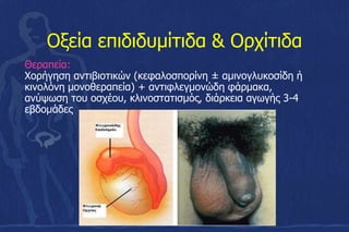 Οξεία επιδιδυμίτιδα & Ορχίτιδα
Θεραπεία:
Χορήγηση αντιβιοτικών (κεφαλοσπορίνη ± αμινογλυκοσίδη ή
κινολόνη μονοθεραπεία) + αντιφλεγμονώδη φάρμακα,
ανύψωση του οσχέου, κλινοστατισμός, διάρκεια αγωγής 3-4
εβδομάδες
 