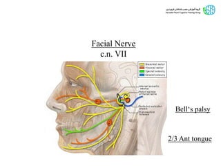 Facial Nerve
c.n. VII
2/3 Ant tongue
Bell‘s palsy