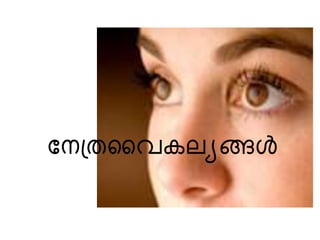 നേത്രവൈകല്യങ്ങൾ
 
