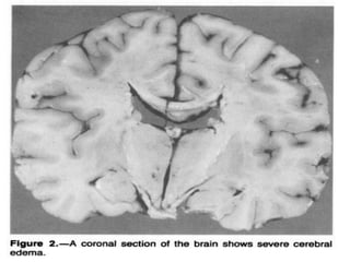 0000000000000000000000000000
0000000
 