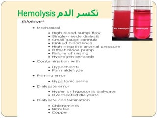 ‫الدم‬ ‫تكسر‬Hemolysis
 
