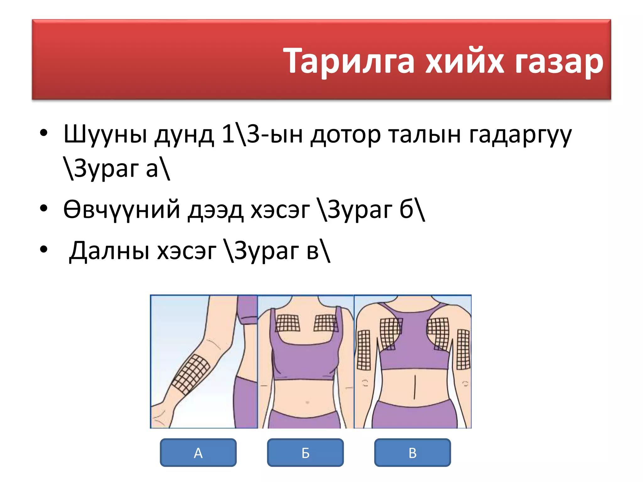 Арьсан доторх тарилга | PPT