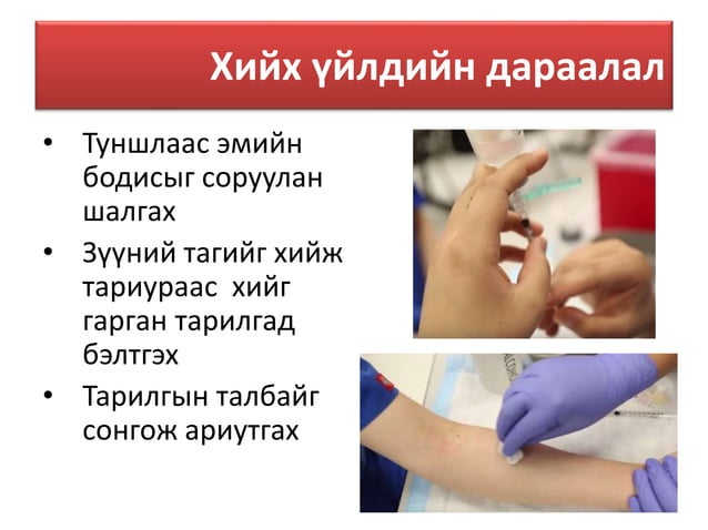 Арьсан доторх тарилга