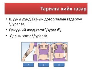 Арьсан доторх тарилга | PPT