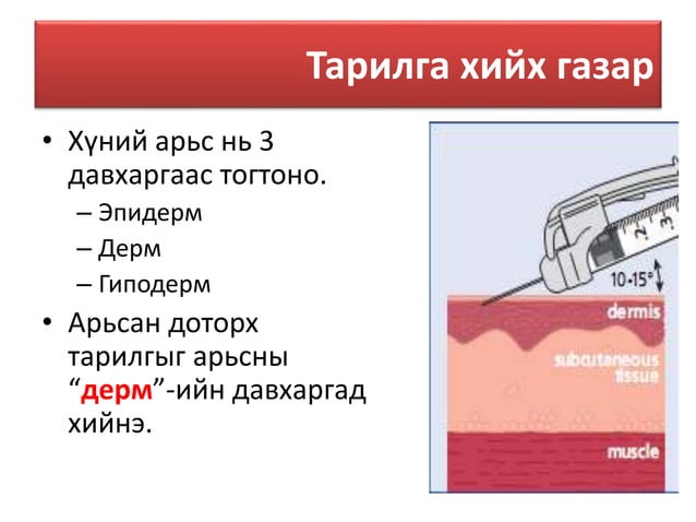 Арьсан доторх тарилга | PPT