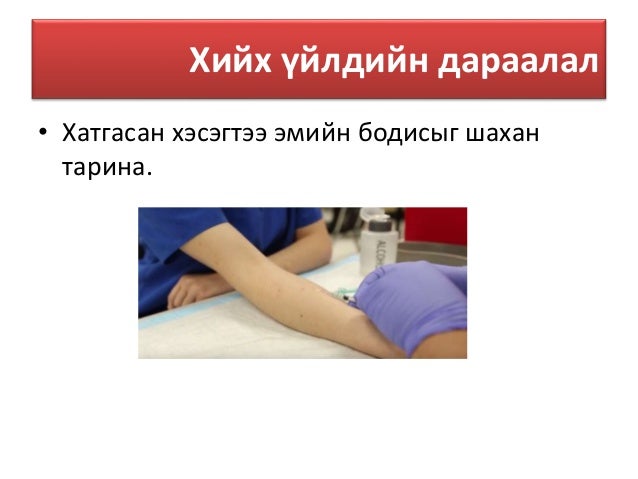 Арьсан доторх тарилга